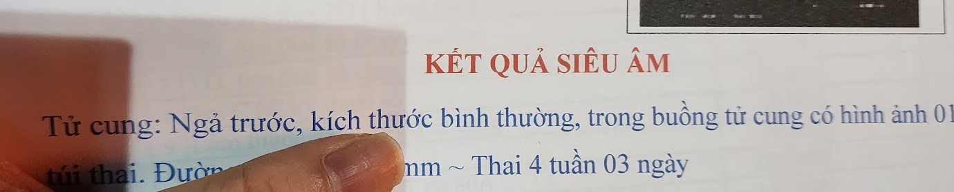 Hình ảnh siêu âm 4 tuần 3 ngày